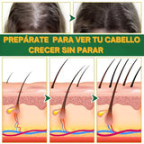 ELHOE HAIR™ - Suero para el crecimiento del cabello 🌿🧔